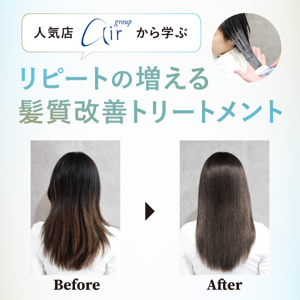 セレクター プロファイブ SP5 （商品特集）